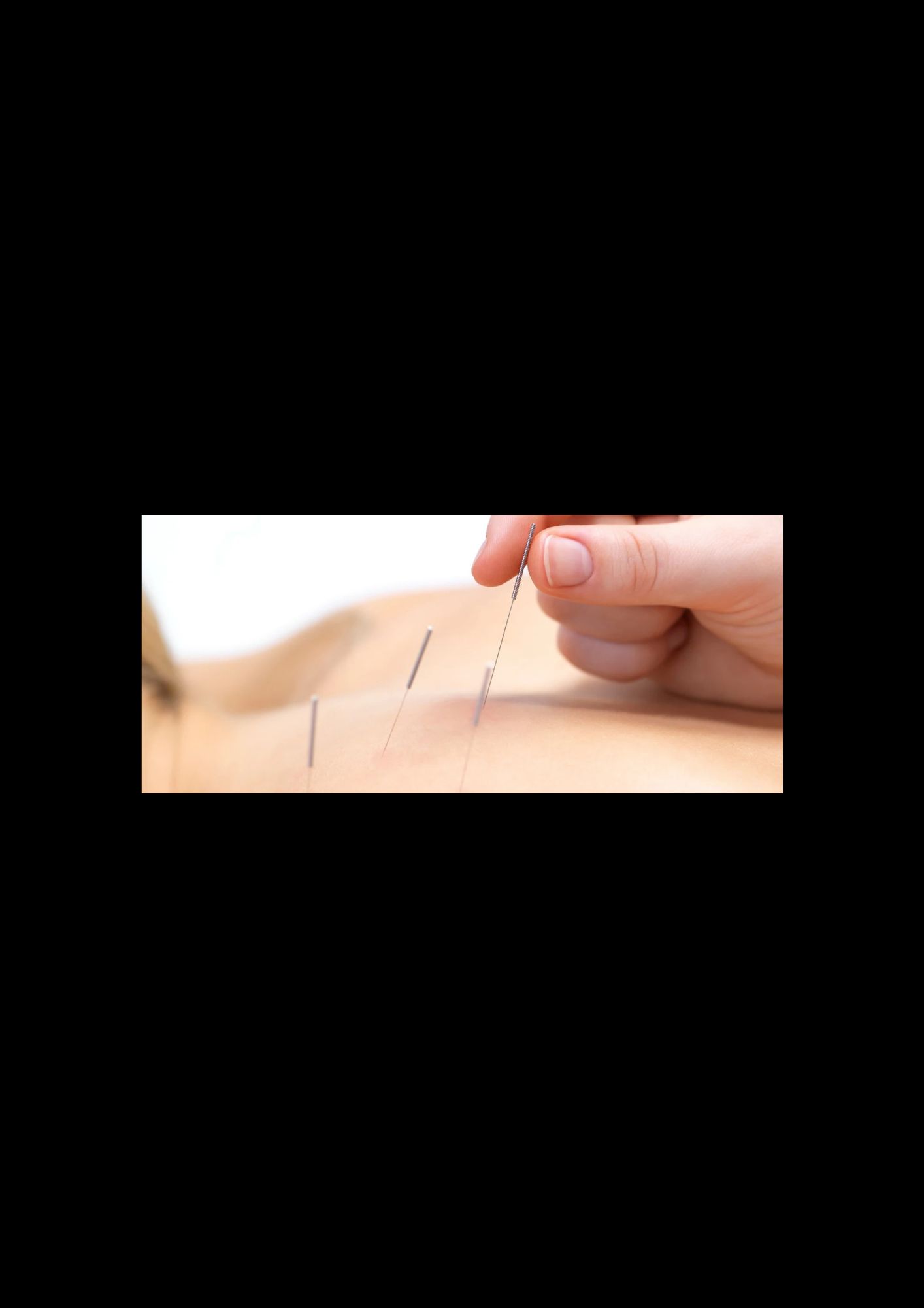 Peel Back Care Clinic – Dry Needling & Remedial Massage