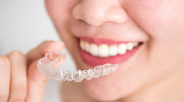 invisalign in chennai
